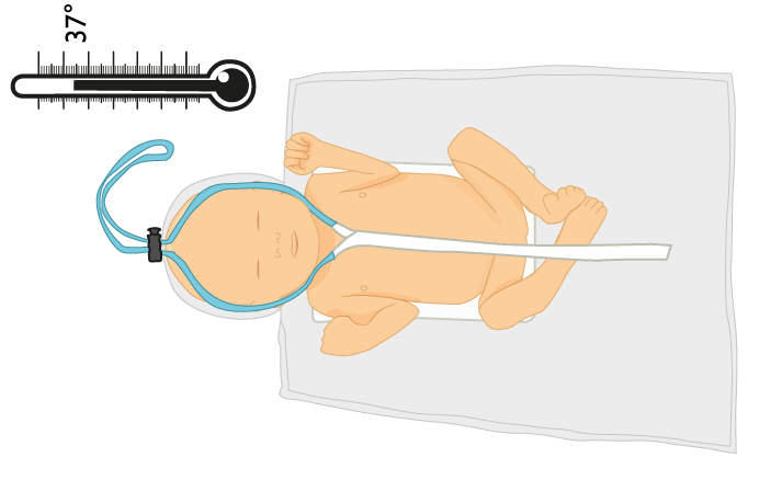 NeoHelp – Neonatal Heat Loss Prevention bag